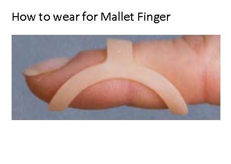OVAL 8 FINGER SPLINT