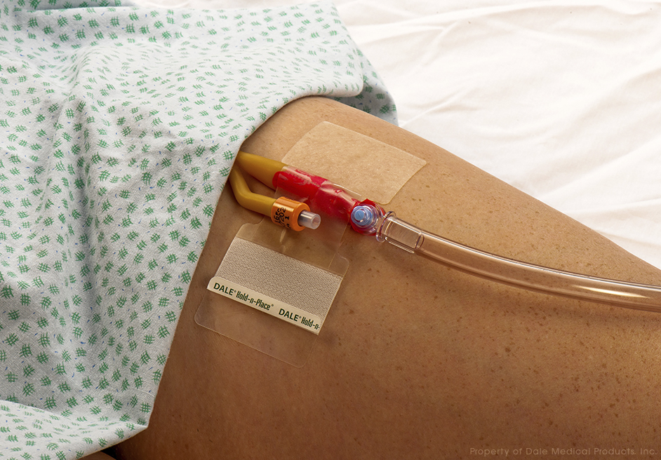Hold-n-Place Foley Catheter Holders